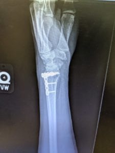 xray of wrist